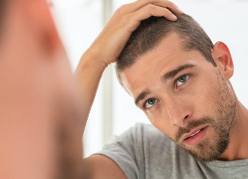 Man looking at his hairline in the mirror