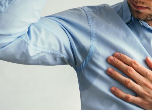 Man suffering from hyperhidrosis