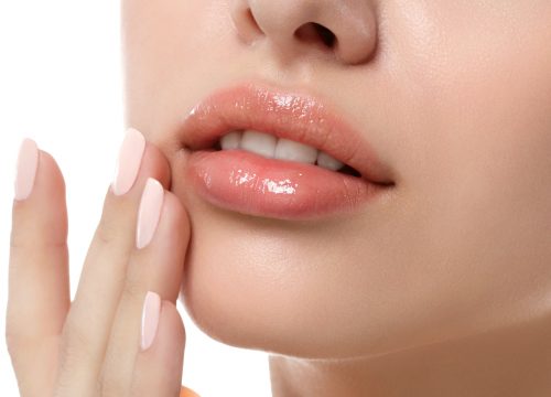 Woman's lips after JUVÉDERM fillers