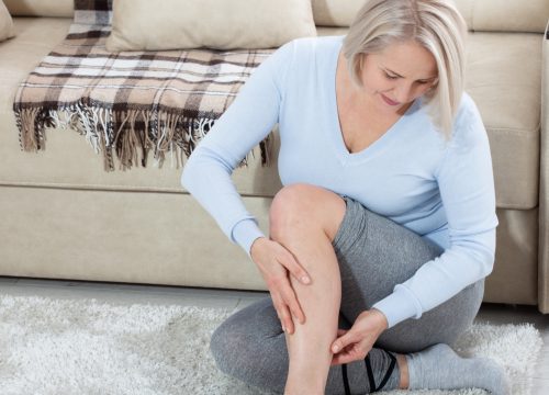 woman checking her legs for spider veins