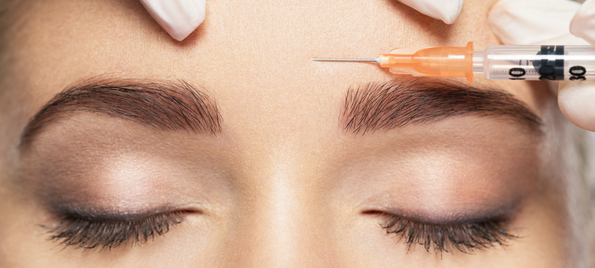 Photo of a woman getting an injectable treatment in her frown line area