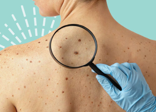 Why Annual Skin Exams Matter: Early Detection Saves Lives