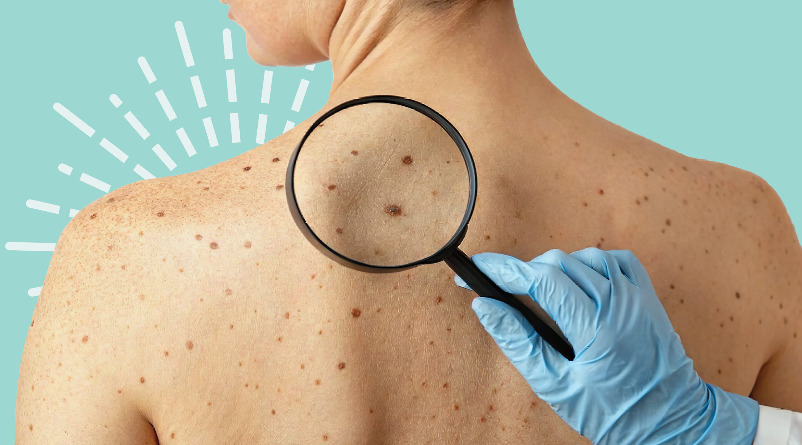 Why Annual Skin Exams Matter: Early Detection Saves Lives