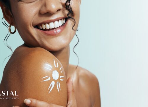 Your SPF Game Plan for Summer