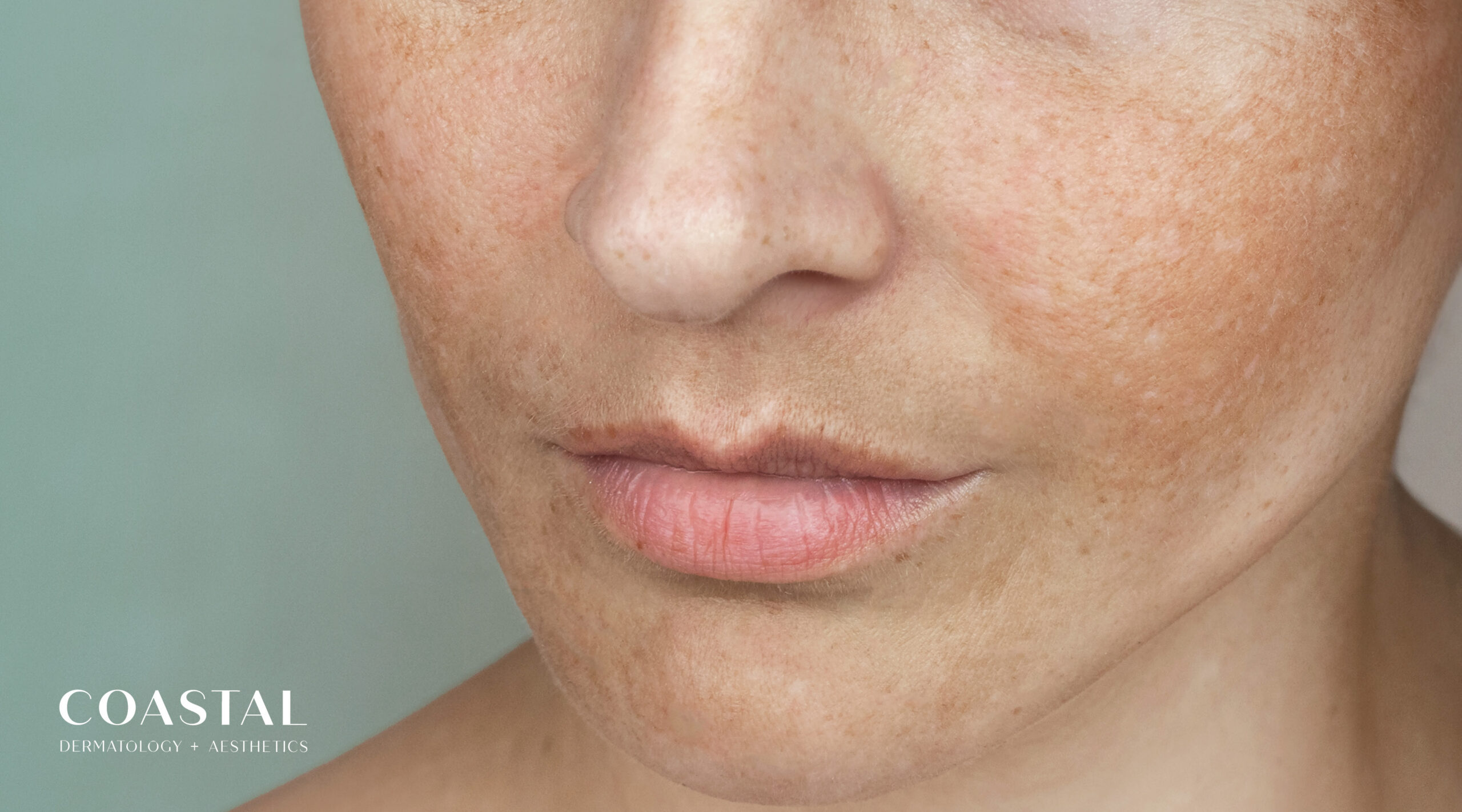 The Truth About Summer Sun Exposure: Debunking the Biggest UV Myths