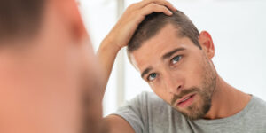 Alopecia