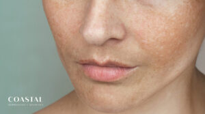 The Truth About Summer Sun Exposure: Debunking the Biggest UV Myths