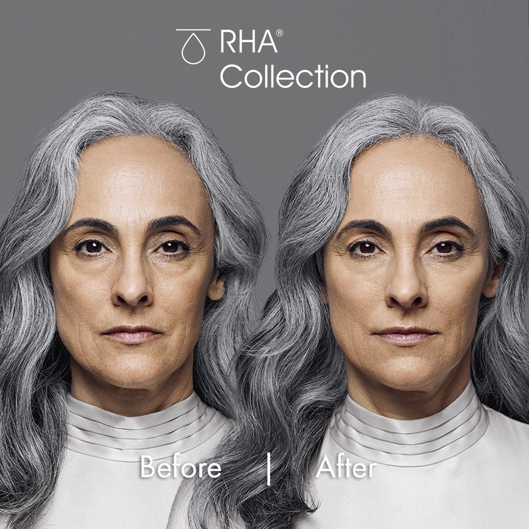 RHA