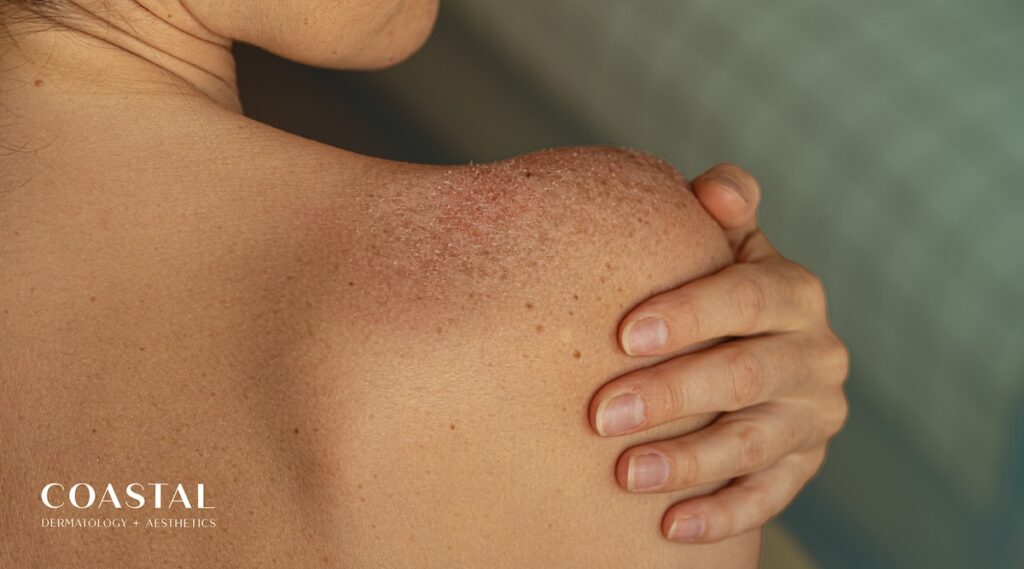 may-26-cd-blog-image