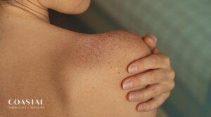 Sun Damage Is Cumulative: What Your Skin Remembers (and What You Can Do About It)